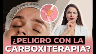 DESCUBRE TODOS LOS BENEFICIOS DE LA CARBOXITERAPIA EN TU CUERPO [upl. by Ibed950]