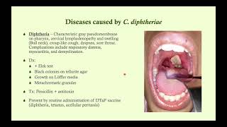 Corynebacterium diphtheriae Diphtheria  Microbiology Boot Camp [upl. by Addie705]