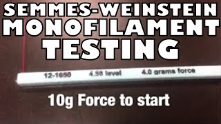 How to Perform the Semmes Weinstein Monofilament Test  Ohio University  Anatomy [upl. by Mitchael]