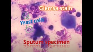 Yeast cells in Giemsa stained smear of sputum [upl. by Hahsi]