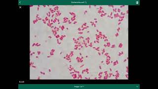 escherichia coli  الإشريكية القولونية [upl. by Uriisa153]