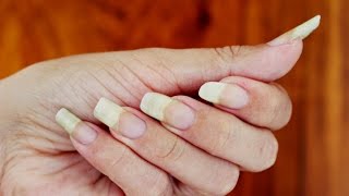 COMO FAZER SUAS UNHAS CRESCEREM MUITO EM POUCOS DIAS [upl. by Modestia]