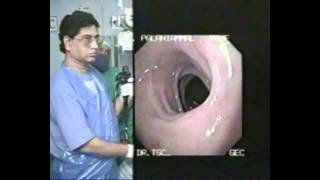 Upper G I Endoscopy Basic Techniques [upl. by Anne575]