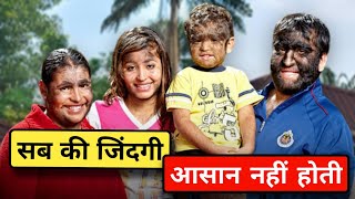 क्योंकि जीना इसी का नाम है worlds Hairiest family Gomez Family Hypertrichosis Disorder in hindi [upl. by Bettine324]