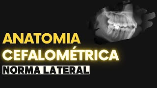 Anatomia cefalométrica Marcação de pontos craniométricos [upl. by Adnohsel]