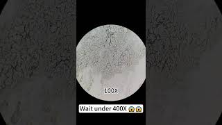 Pimples at 400X magnification are really cool underthemicroscope beefcut scienceshorts [upl. by Noram780]