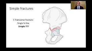 Kasr Al Ainy Postgraduate Orthopaedic Review Course  Acetabular Fractures Principles of Management [upl. by Ulysses392]