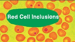 Various forms of RBCs anisocytosis poikilocytosis RBCinclusions 2023 sachinpunia [upl. by Etessil]