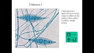 Identification of dermatophytes [upl. by Ahsemit445]