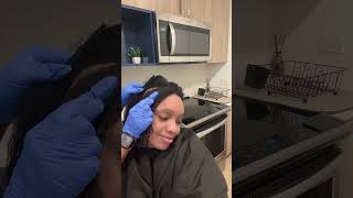 Seborrheic Dermatitis scalp care Follow and subscribe for more info [upl. by Maletta]