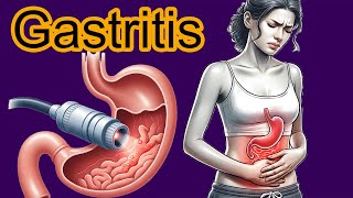 5 Early signs of Gastritis Gastritis diagnosis and treatment [upl. by Nylirak]