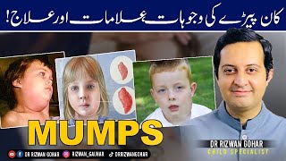 MUMPS SYMPTOMS amp HOME TREATMENT Mumps treatment [upl. by Vite]