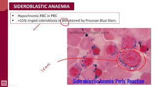 Hematology  1  U8L4  Sideroblastic anaemia [upl. by Hodges634]