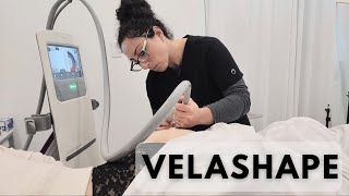 Shape Up with VelaShape III Your Ultimate Guide to Body Contouring [upl. by Carita]