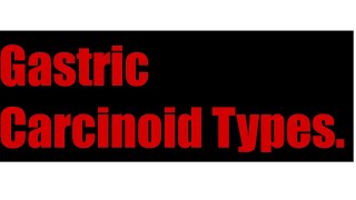 Gastric Carcinoid Types [upl. by Oijile]