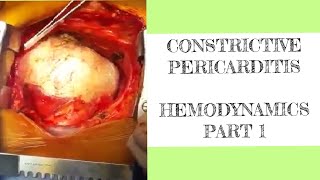 Constrictive pericarditis hemodynamics  1 [upl. by Flight]