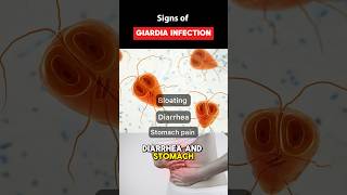 IBS Symptoms or Giardia Parasite Infection guthealth youtubeshorts shorts [upl. by Nehpets959]