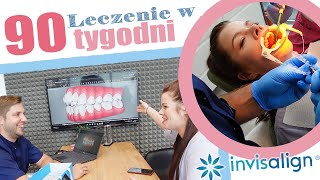 Niewidoczny aparat CZY TO BOLI Jak wygląda założenie aparatu ortodontycznego invisalign [upl. by Eelaras]