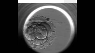 EmbryoScope  artificial fertilization technique [upl. by Skricki]