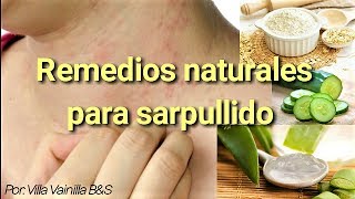 Remedios naturales para sarpullido [upl. by Nivre]