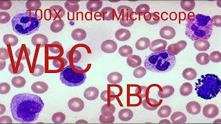 How to WBC count under Microscope [upl. by Verene]