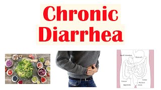 Chronic Diarrhea Approach to Cause Secretory vs Osmotic vs Inflammatory Watery vs Bloody Diarrhea [upl. by Ateuqram]