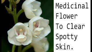 Dove  Orchid Or Holy Ghost Orchid Peristeria Elata  Medicinal Flower To Clear Spotty Skin [upl. by Ohl]