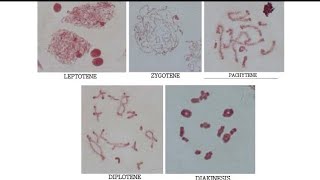 QUICK GUIDE TO MEIOTIC CELL DIVISION STAGES [upl. by Dyolf]