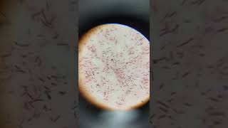 Lactobacillus bacteria under microscope  bacteria in curd [upl. by Enitram]