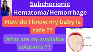 Subchorionic Hematoma My baby is safe or not Medications for Subchorionic hematoma [upl. by Izawa118]