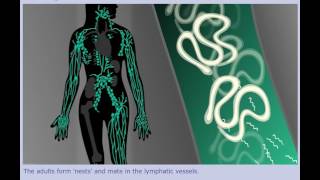 Lymphatic Filariasis Elephantiasis  Life Cycle [upl. by Nahum]