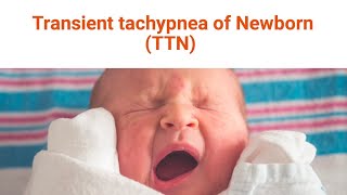 Transient Tachypnea of the Newborn [upl. by Genet]