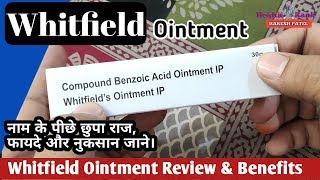 Whitfield Ointment  History Review and Benefits in Hindi  Health Rank [upl. by Wemolohtrab952]