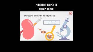 Puncture  biopsy of kidney tissue puncture kidneyhealth kidneydisease biopsy [upl. by Cirdet]