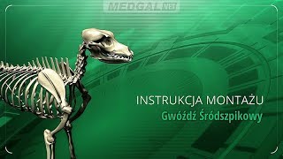 Gwóźdź Śródszpikowy [upl. by Dott512]