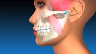 TMJ Explanation amp Therapy [upl. by Reggy]