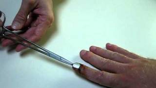 Kent Trivette getting metal pin pulled out of finger [upl. by Cirdor]