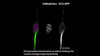 Microtubules spin the nucleus during neuronal migration [upl. by Herries296]