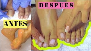 Así me cuido mis uñas de los piesMy Pedicure rutineComo limpiar las uñas [upl. by Feld]