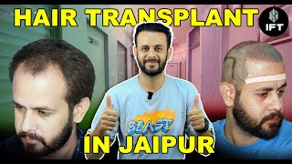 Hair Transplant in Jaipur  Advanced Interlocking FUE Technique at IFT Hair Science [upl. by Htelimay201]