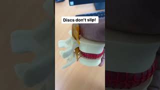 Slip Disc Herniated Disc [upl. by Obola]