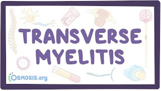 Transverse myelitis  an Osmosis Preview [upl. by Adnamaa]