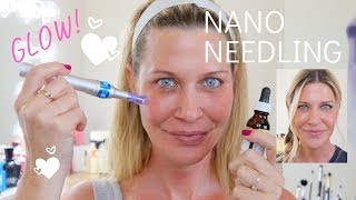 ☀️Nano Needling  How to needle at home for SERIOUS glow [upl. by Boardman]