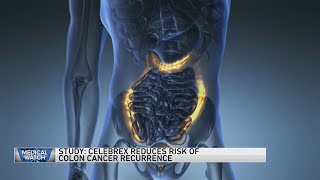 Study Celebrex reduces risk of colon cancer recurrence — and more [upl. by Harriette]