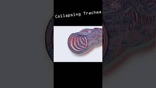 Collapsing Trachea in dogs shorts [upl. by Adnohsar688]