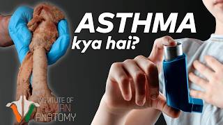 Asthma Kya Hai Aur Iska Ilaj Kaise Kiya Jata Hai  Ek Gehra Nazariya Sans Ki Bimari Par in Hindi [upl. by Strawn176]