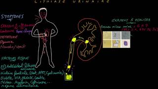 Lithiase urinaire  Docteur Synapse [upl. by Aira]