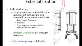 Orthopaedic trauma for med students 2 [upl. by Ruon]