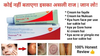 Tenovate M skin cream honest review 2022 🔥👍 Must watch [upl. by Ades]