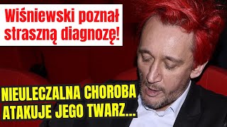 WIŚNIEWSKI POZNAŁ PRZERAŹLIWĄ DIAGNOZĘ NIEULECZALNA CHOROBA „ATAKUJE JEGO TWARZ” [upl. by Raynell]